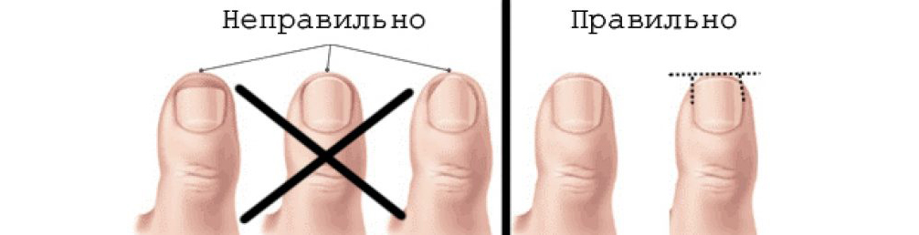 Лечение вросшего ногтя в Москве - Beauty Practice